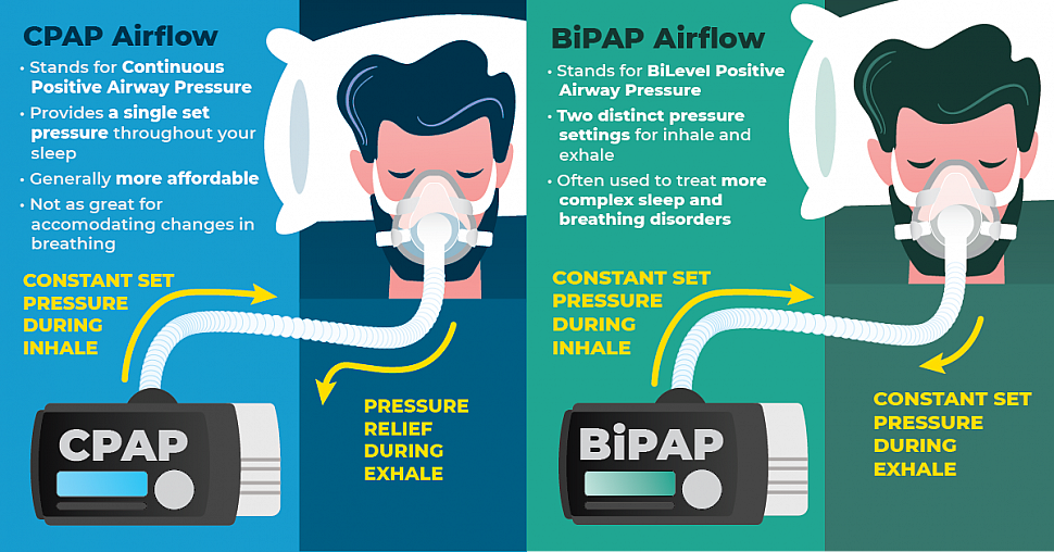 В чем отличия между СИПАП- и БИПАП-терапией фото